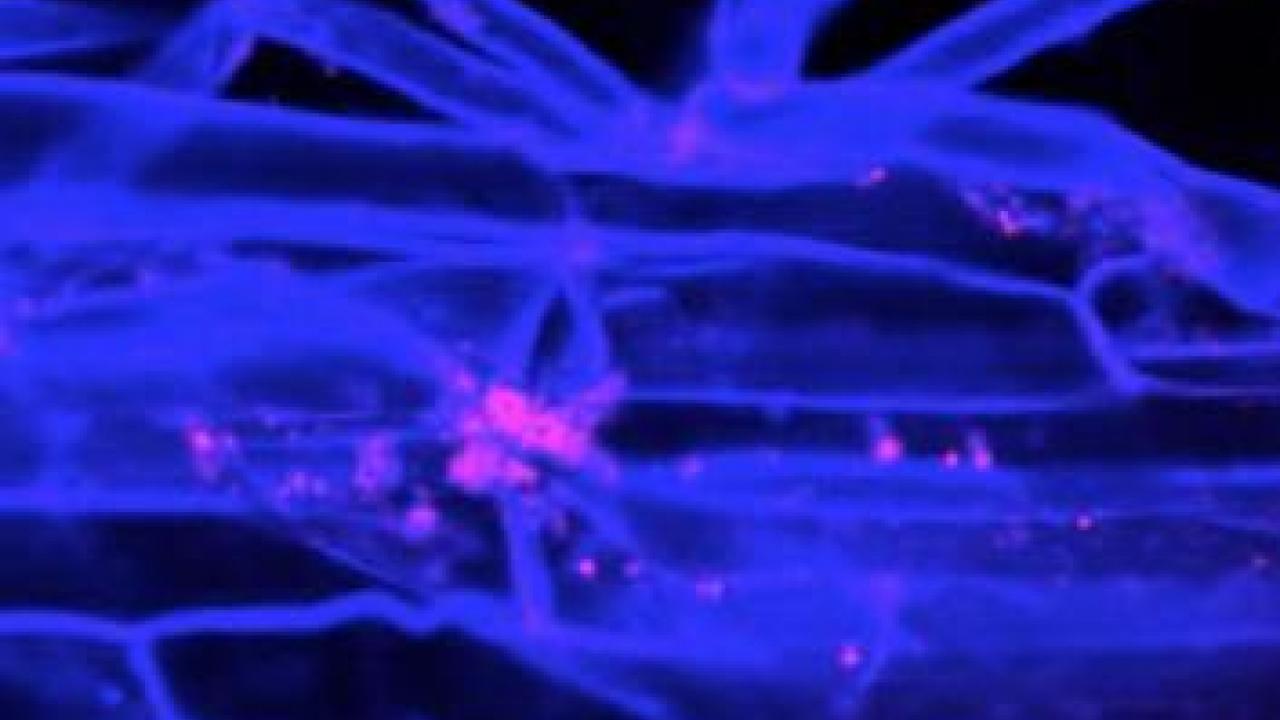 Fluorescent probes in bacteria