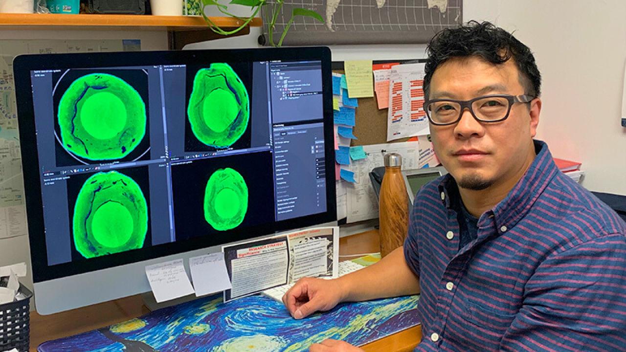 Man sitting by scans of brain