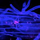 Fluorescent probes in bacteria